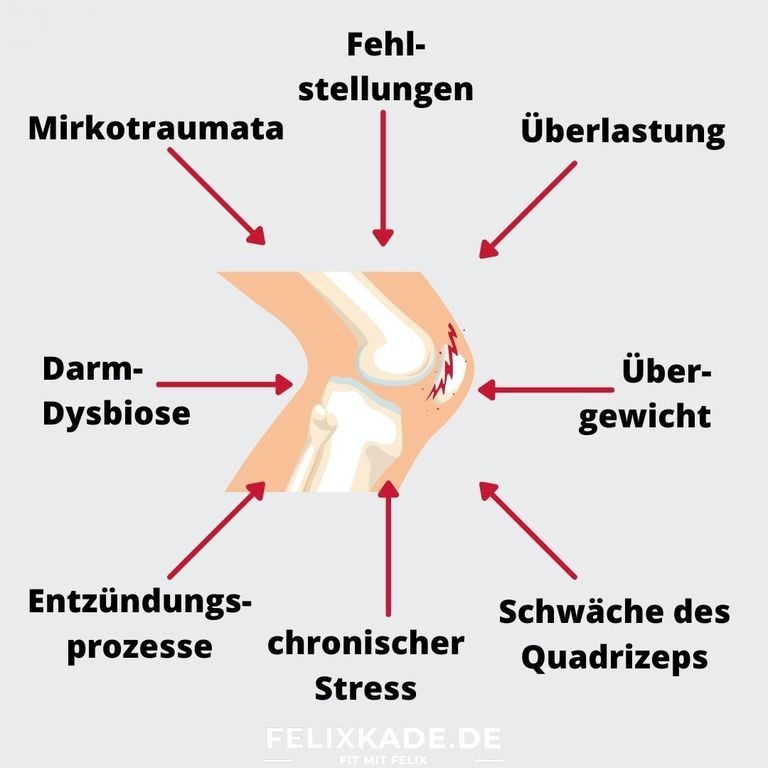 Knirschen im Knie Wie schlimm ist es wirklich? www.felixkade.de