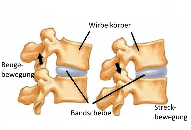 5 Übungen bei akutem Bandscheibenvorfall in der Lendenwirbelsäule