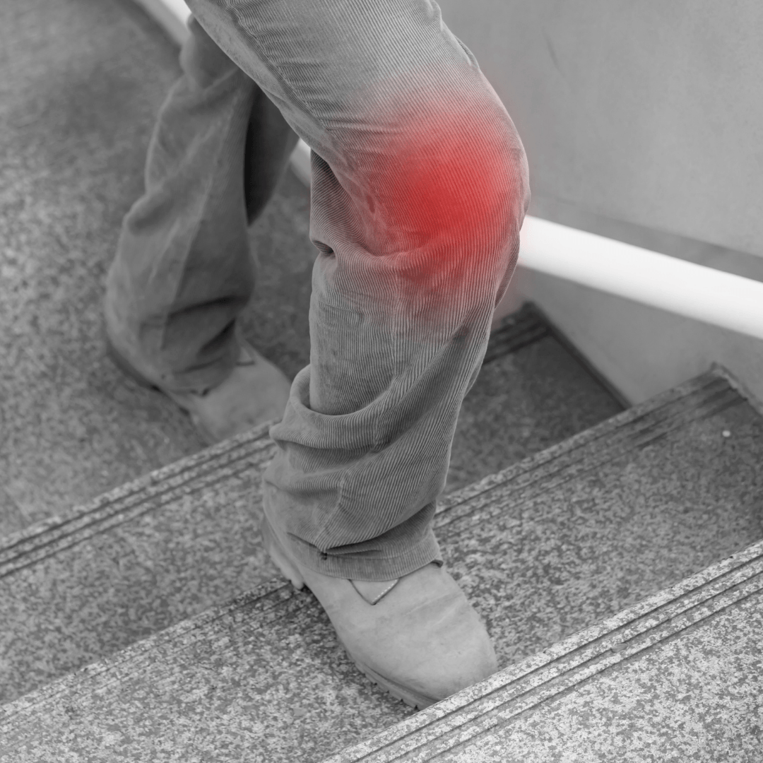 Chondropathie-im-Knie-1 Treppensteigen und Knieschmerzen