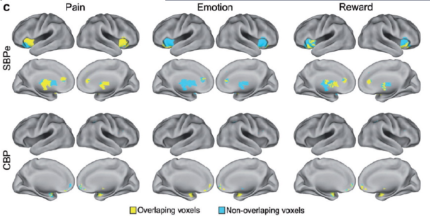 Shape Shifting Pain