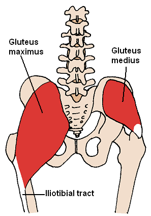 gluteus Medius gluteale Tendinopathie