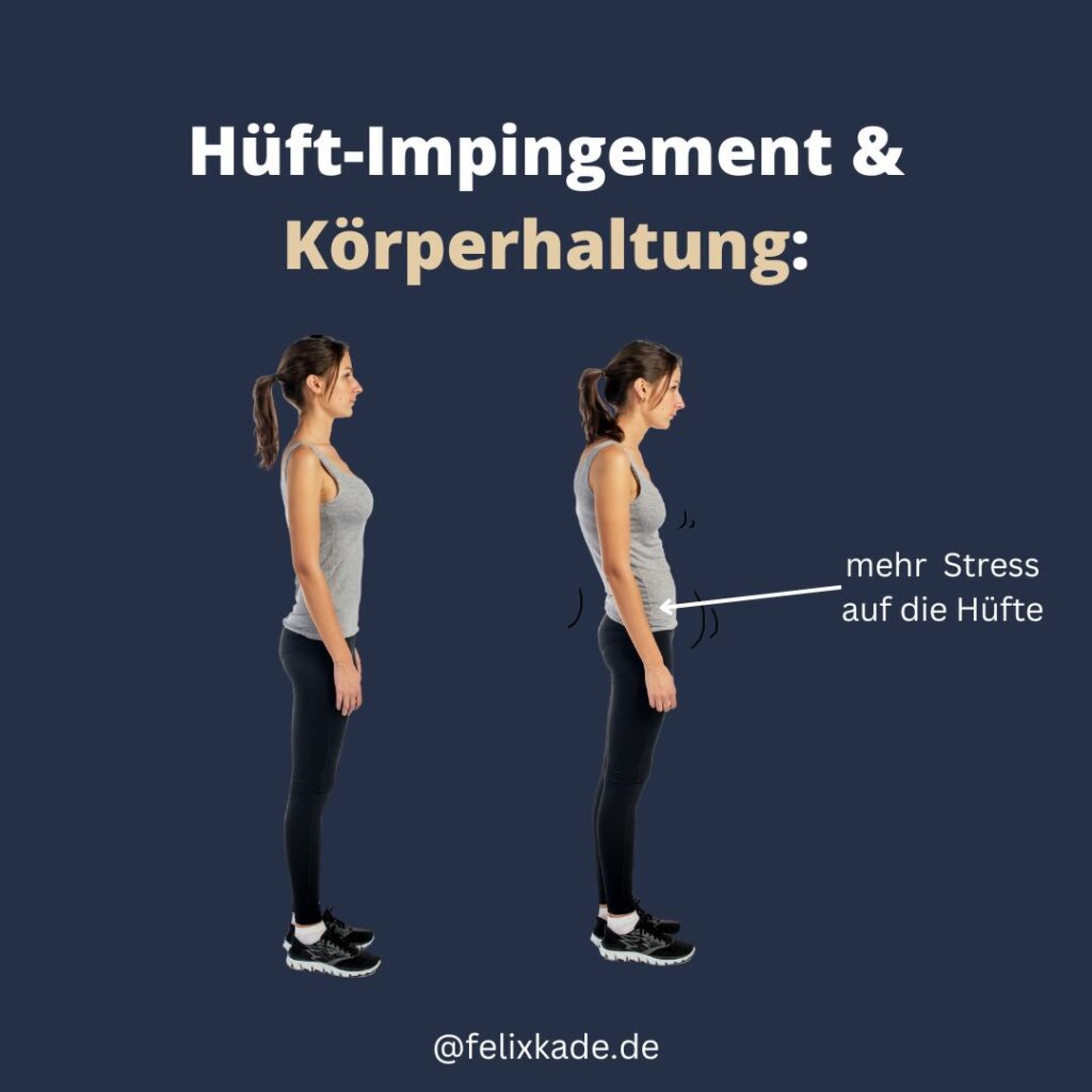 Hüft Impingement und Körperhaltung